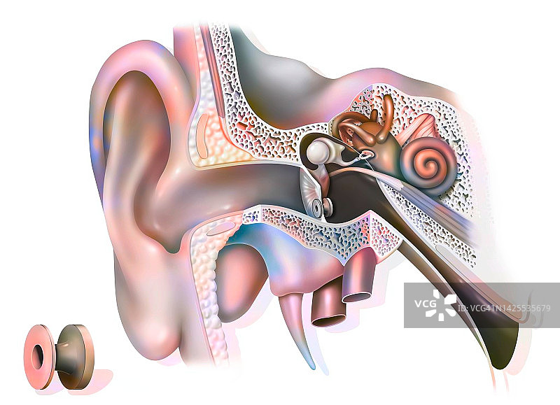 耳炎治疗图图片素材