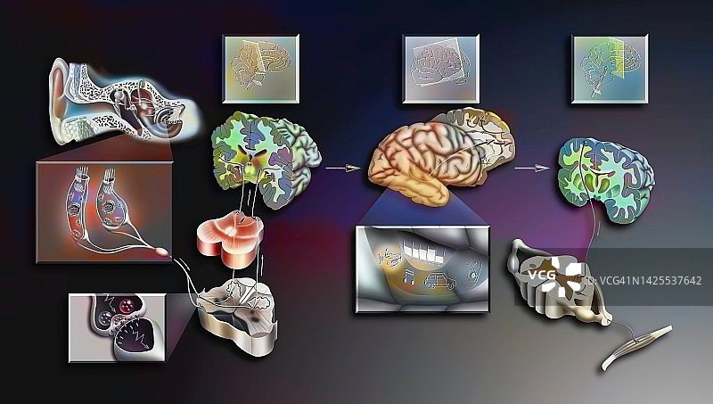 听力图图片素材
