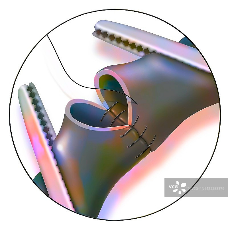 动脉图图片素材