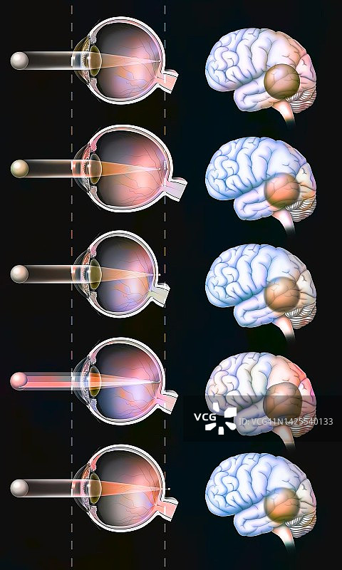眼睛问题图图片素材