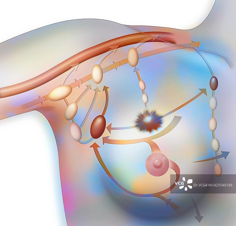 淋巴结图图片素材