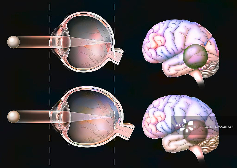 近视绘画图片素材