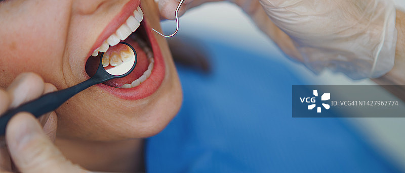 年轻女子在救护车上进行牙科检查特写图片素材