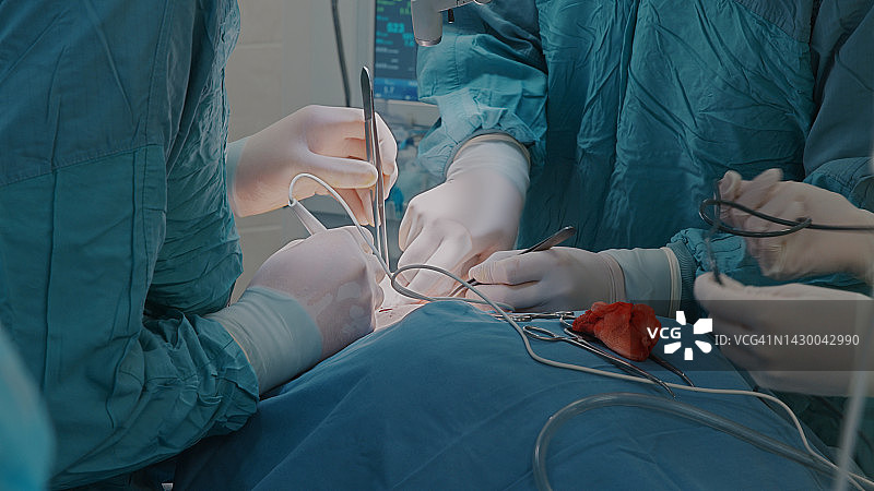 外科医生在护士的帮助下进行手术特写图片素材