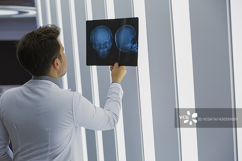 正在检查X光片的男医生图片素材