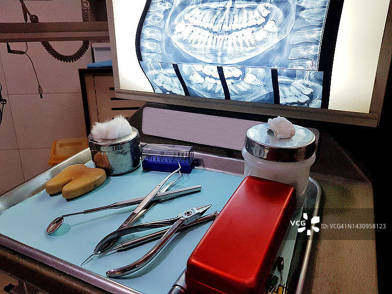 灯箱上的人类牙齿X光片图片素材