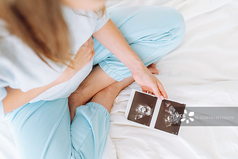试管婴儿：体外受精，孕期超声波检查结果，孕妇展示胎儿超声照片图片素材