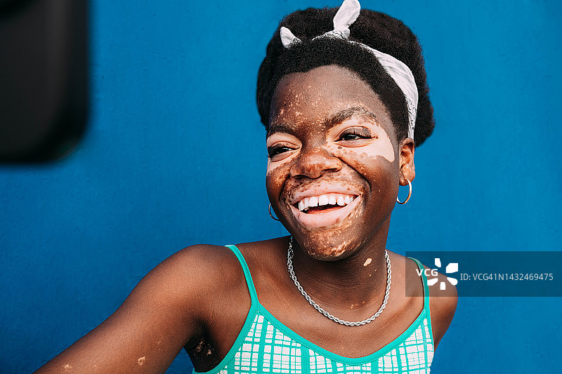 患有白癜风的美丽女孩笑着自拍图片素材