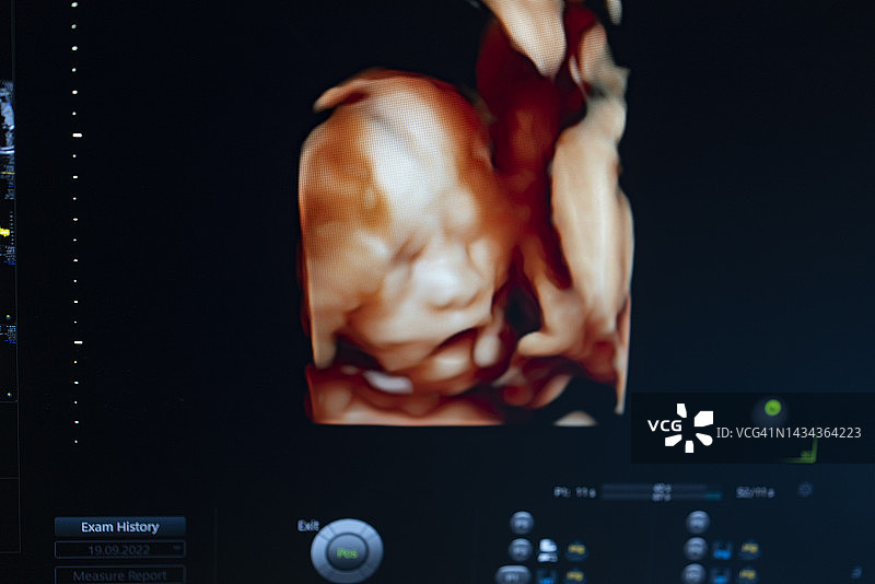 医生使用3D超声波扫描仪为怀孕22周的年轻患者检查胎儿图片素材