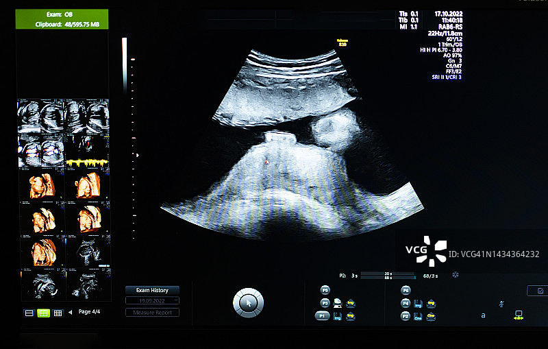 医生使用3D超声波扫描仪为怀孕22周的年轻患者检查胎儿图片素材