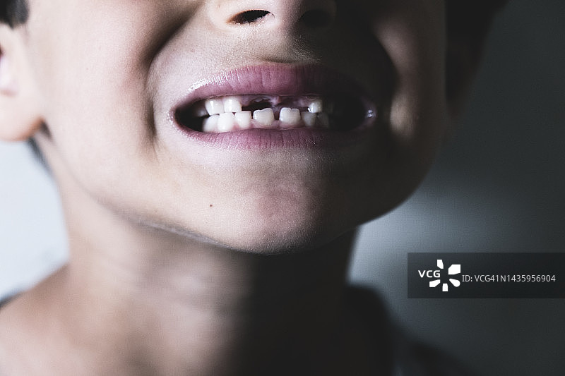 掉了一颗牙，高兴地张开嘴巴的男孩的画像图片素材