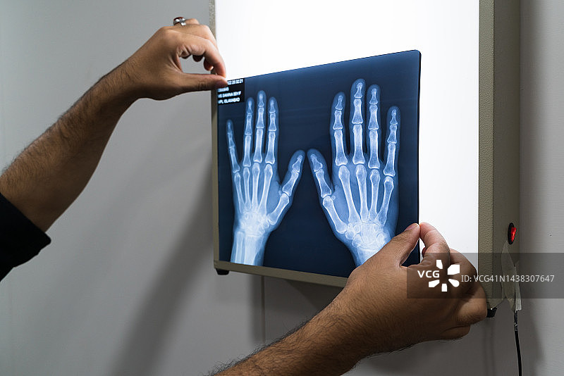 男放射科医生手持X光片图片素材