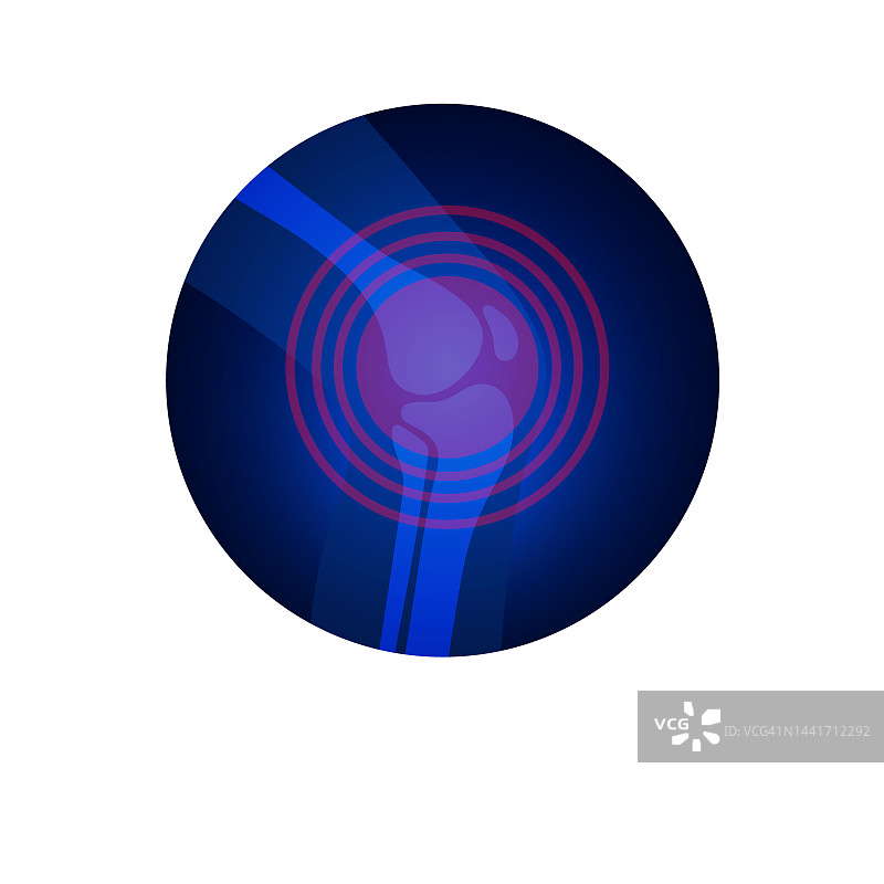 膝关节疼痛概念图图片素材