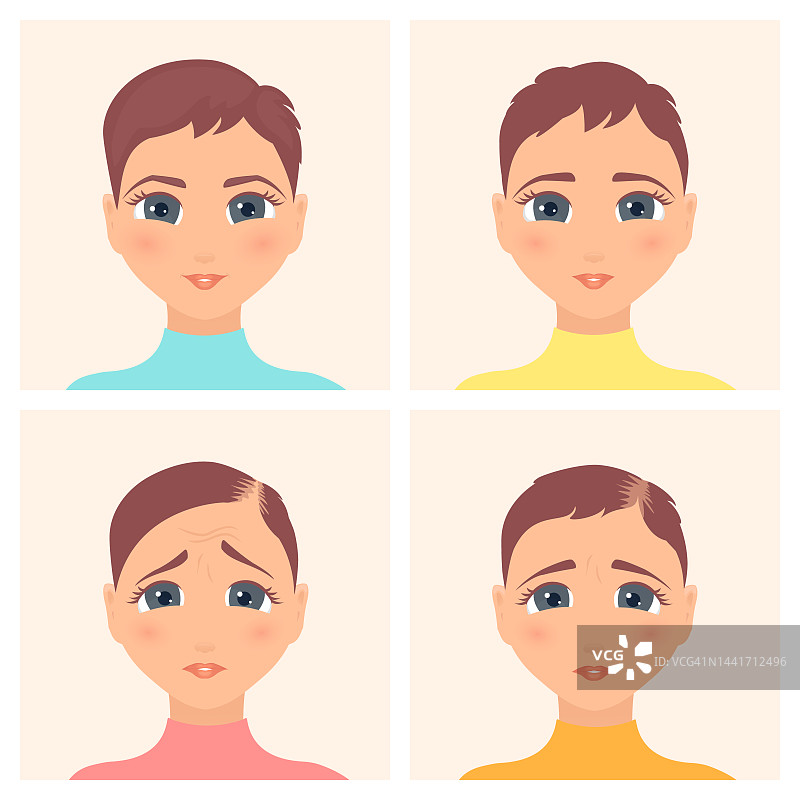 女性脱发阶段，图示图片素材