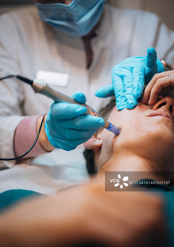 年轻男子接受Dermapen微针治疗图片素材
