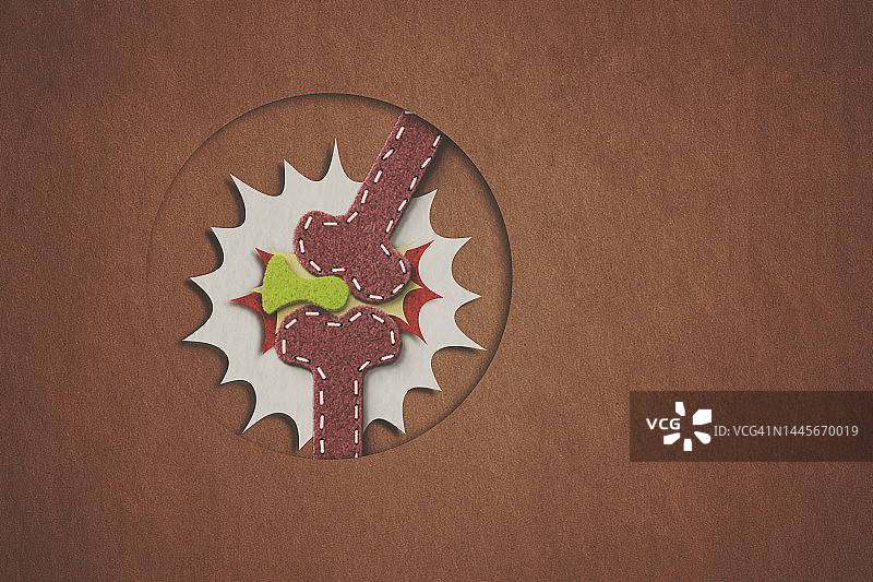 膝关节疼痛示意图图片素材