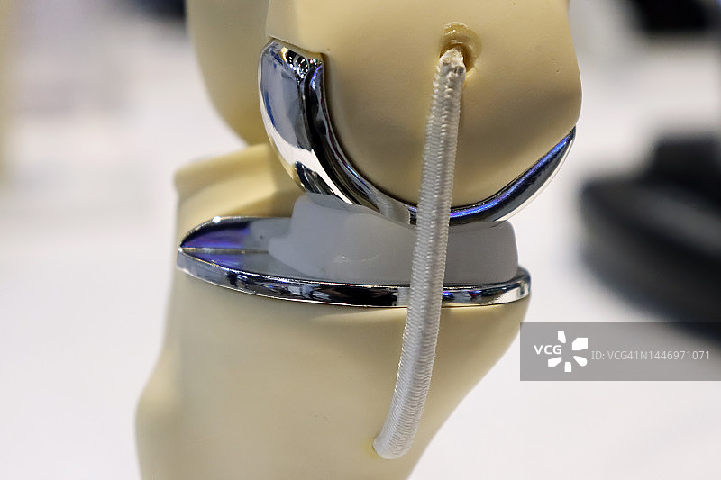 膝关节置换图片素材