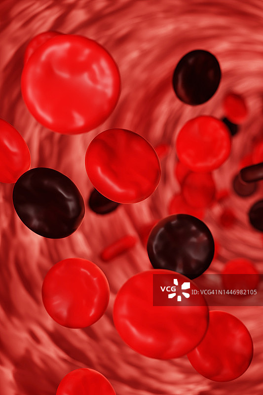 红黑血细胞在动脉中流动，胆固醇与血液疾病概念的3D竖版图案图片素材