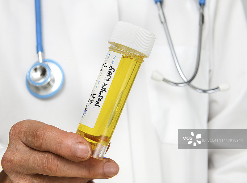 尿液检查图片素材