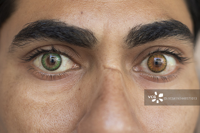 具有虹膜异色症的眼睛特写图片素材