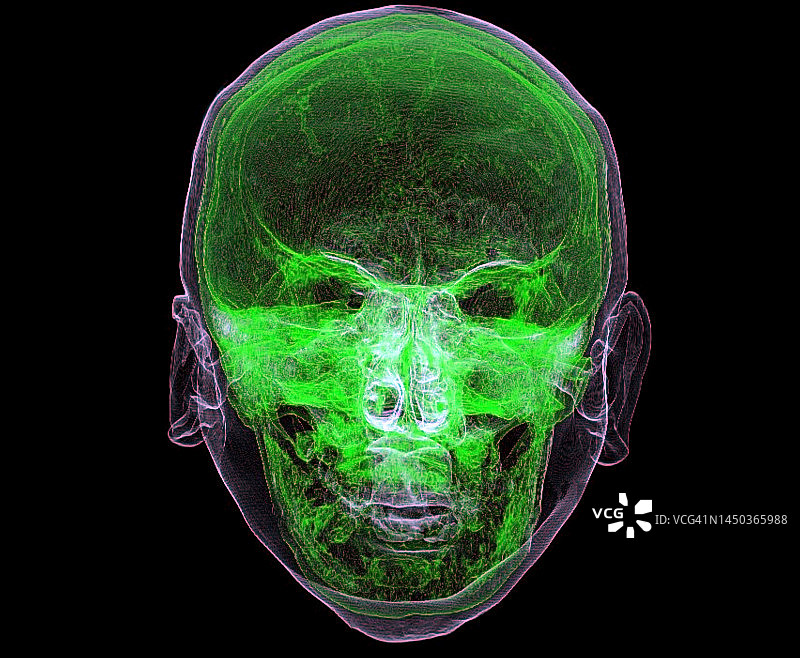 头部CT扫描图片素材