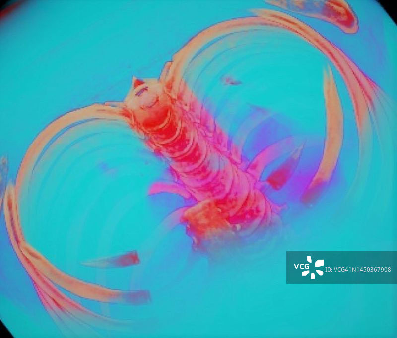 肋骨和脊柱3D CT扫描图片素材