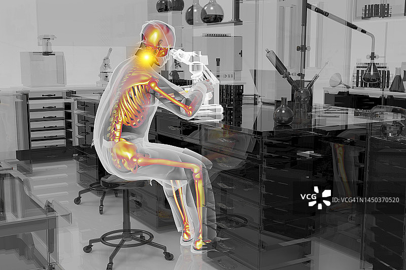 实验室工作人员的肌肉骨骼疾病插图图片素材