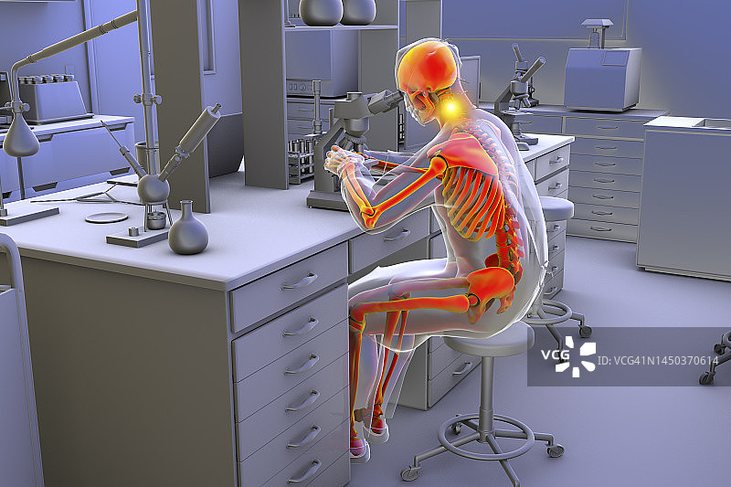 实验室工作人员的肌肉骨骼疾病插图图片素材