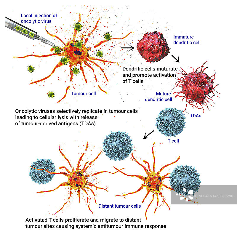 溶瘤病毒疗法，图示图片素材