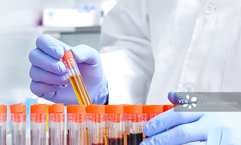 戴着蓝色防护手套的男人手持样品管的特写图片素材