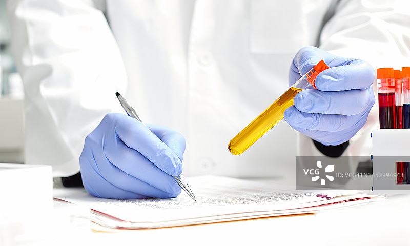 戴着蓝色防护手套的男人手持样品管的特写图片素材