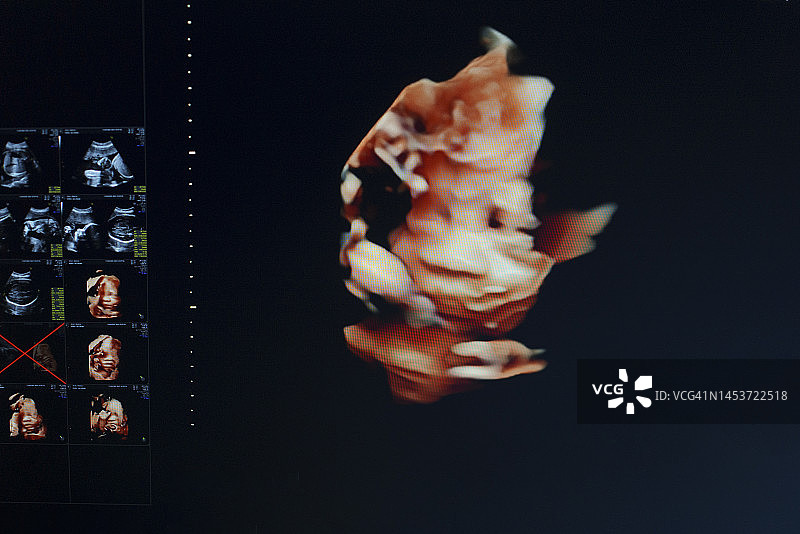 医生为年轻孕妇进行胎儿超声波检查图片素材