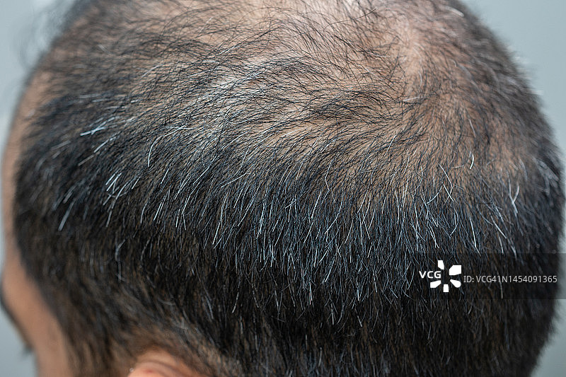 亚洲男人头部秃顶白发特写图片素材