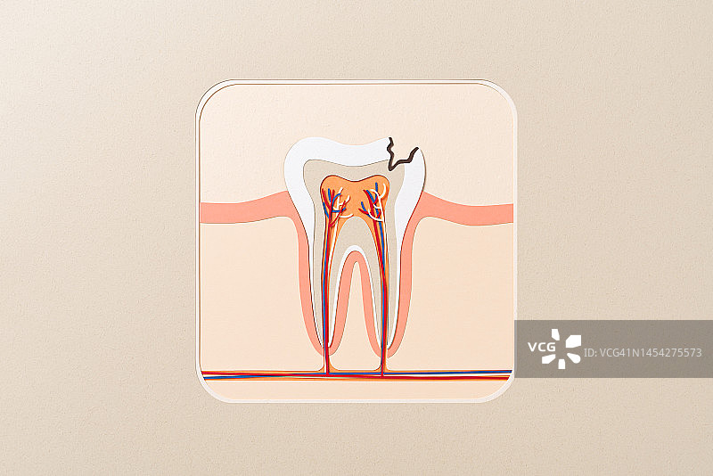 龋齿横截面解剖结构剪纸工艺图片素材