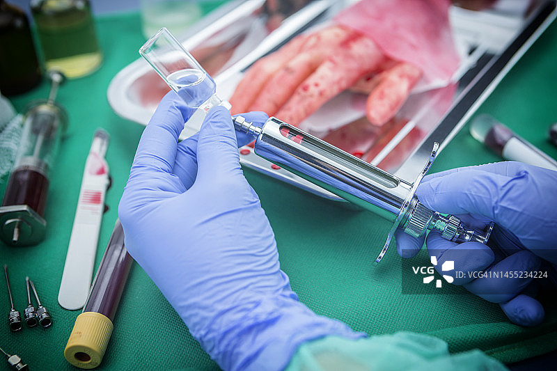 手移植概念图图片素材