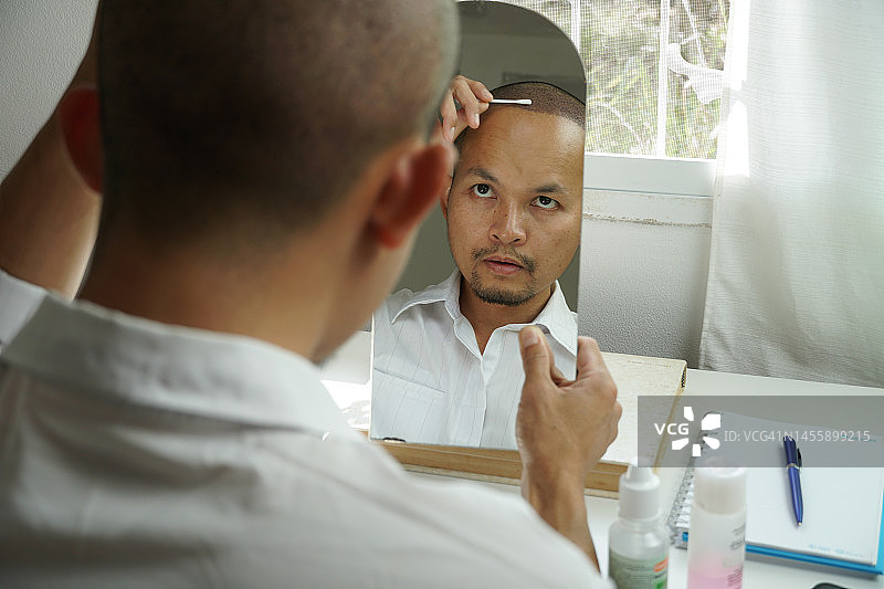 亚洲男人植发：术后清理头皮图片素材