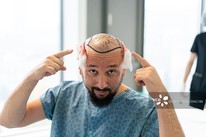 植发手术全过程图片素材