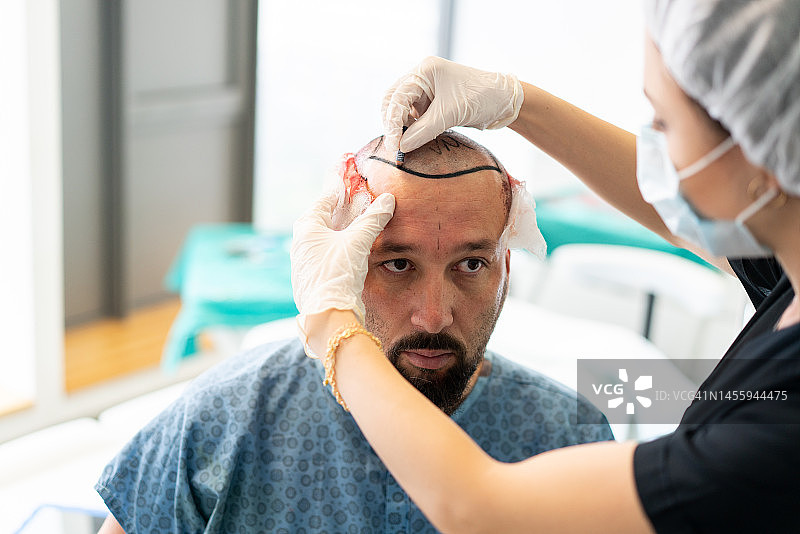 植发手术全过程图片素材