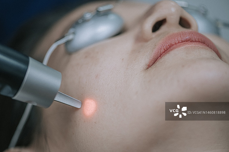 中国男美容师在诊所为女顾客进行激光IPL治疗图片素材