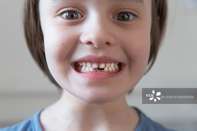 儿童掉了牙齿：宝宝没牙的特写图片素材