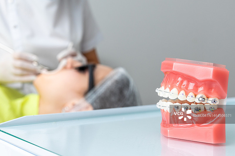 正畸模型和牙医工具：多种牙齿模型图片素材