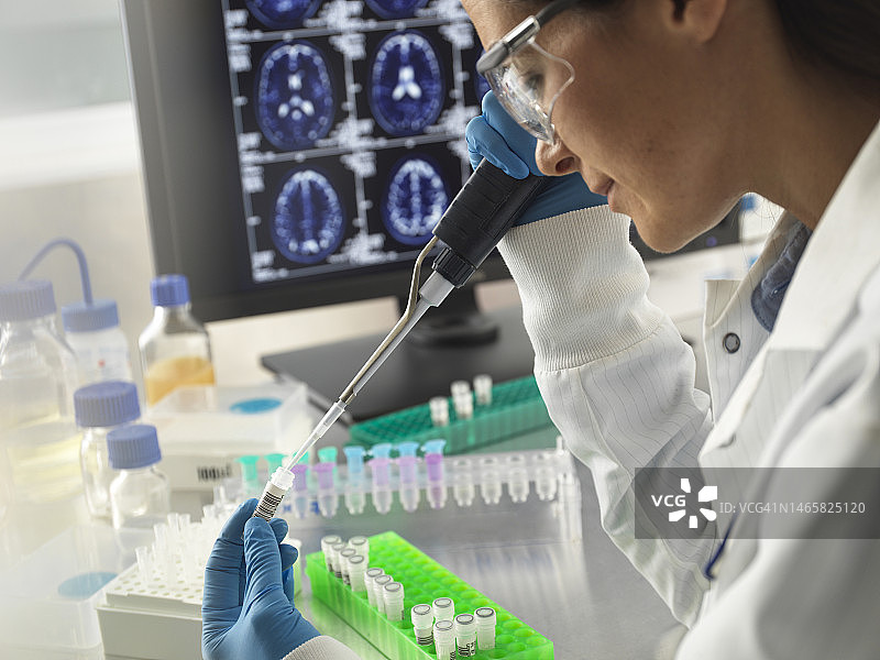 阿尔茨海默病和痴呆症研究图片素材