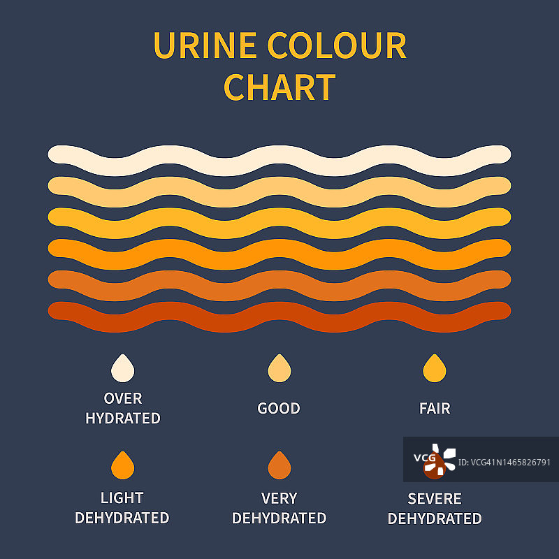 尿液颜色图表示例图片素材