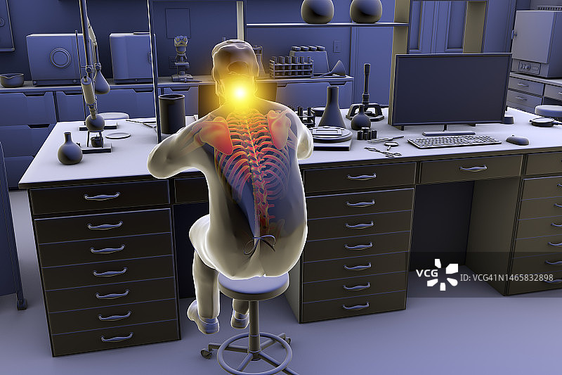 实验室工作人员的肌肉骨骼疾病插图图片素材