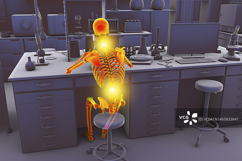 实验室工作人员的肌肉骨骼疾病插图图片素材