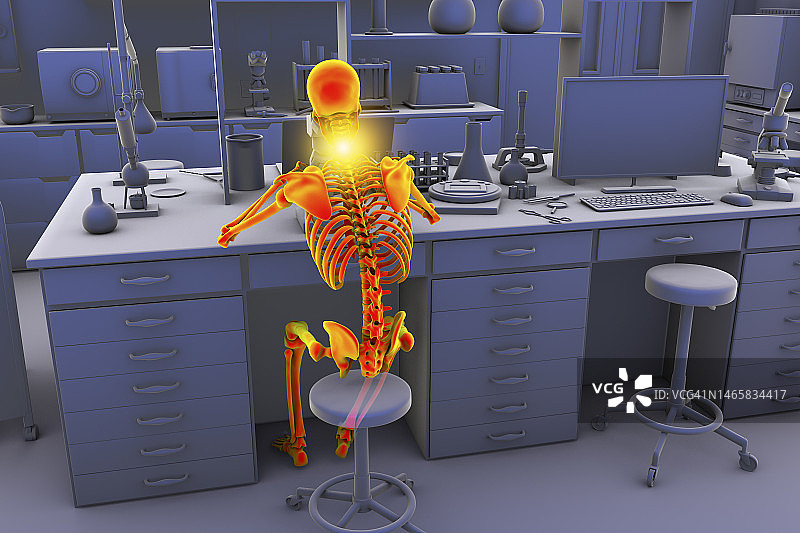 实验室工作人员的肌肉骨骼疾病插图图片素材