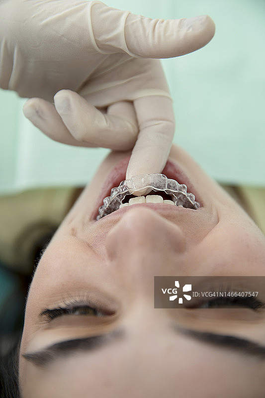 青少年女孩在牙医处戴上透明牙套图片素材