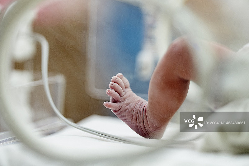 选择性聚焦：带有脉搏传感器的亚洲新生儿的脚在保温箱中移动图片素材