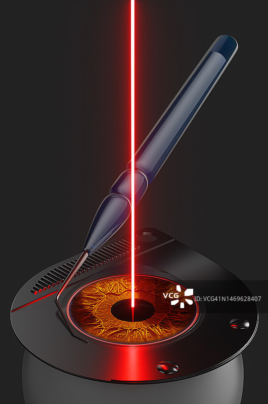 使用激光进行白内障人眼晶体摘除手术图片素材