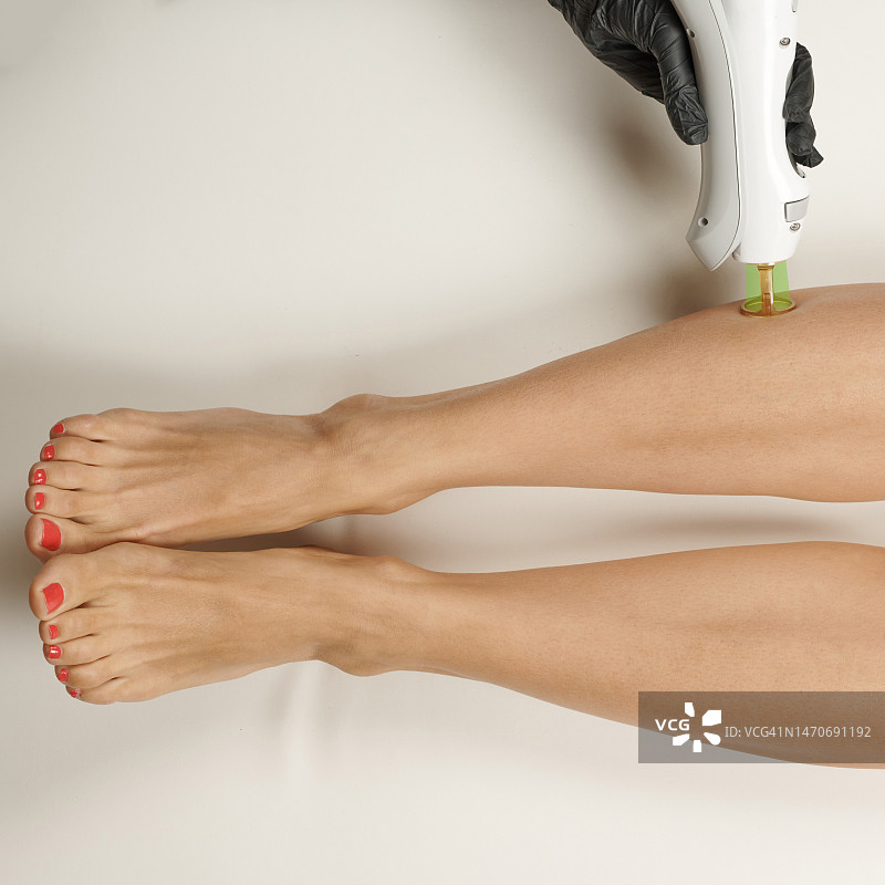 医生手持美容设备，为床上女性进行小腿激光脱毛图片素材